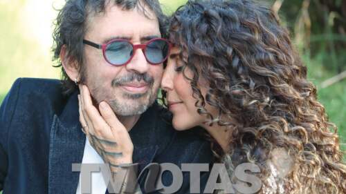 Vica Andrade reveló que se retiró los implantes para cuidar su salud