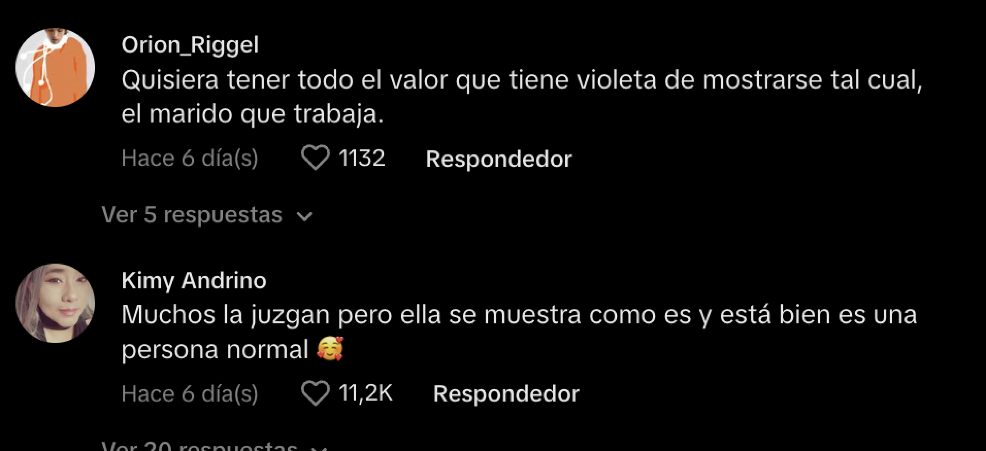 Violeta Isfel muestra cómo lucen sus dientes naturales ¿Le dice adiós a las carillas?
