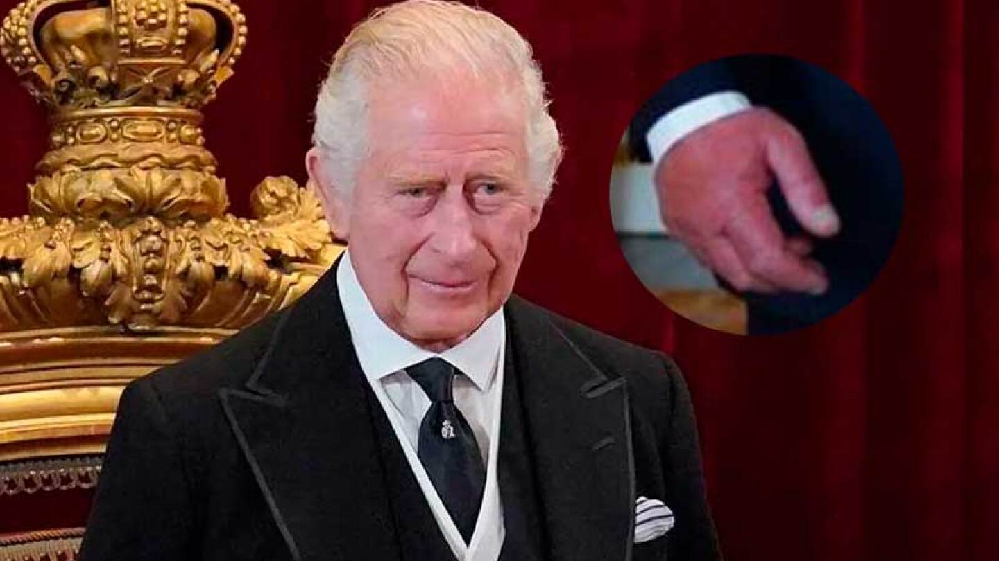El Rey Carlos III podría tener problemas severos de salud