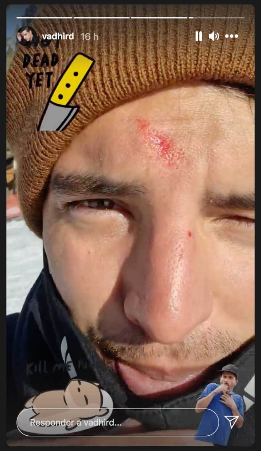 Vadhir Derbez se accidentó