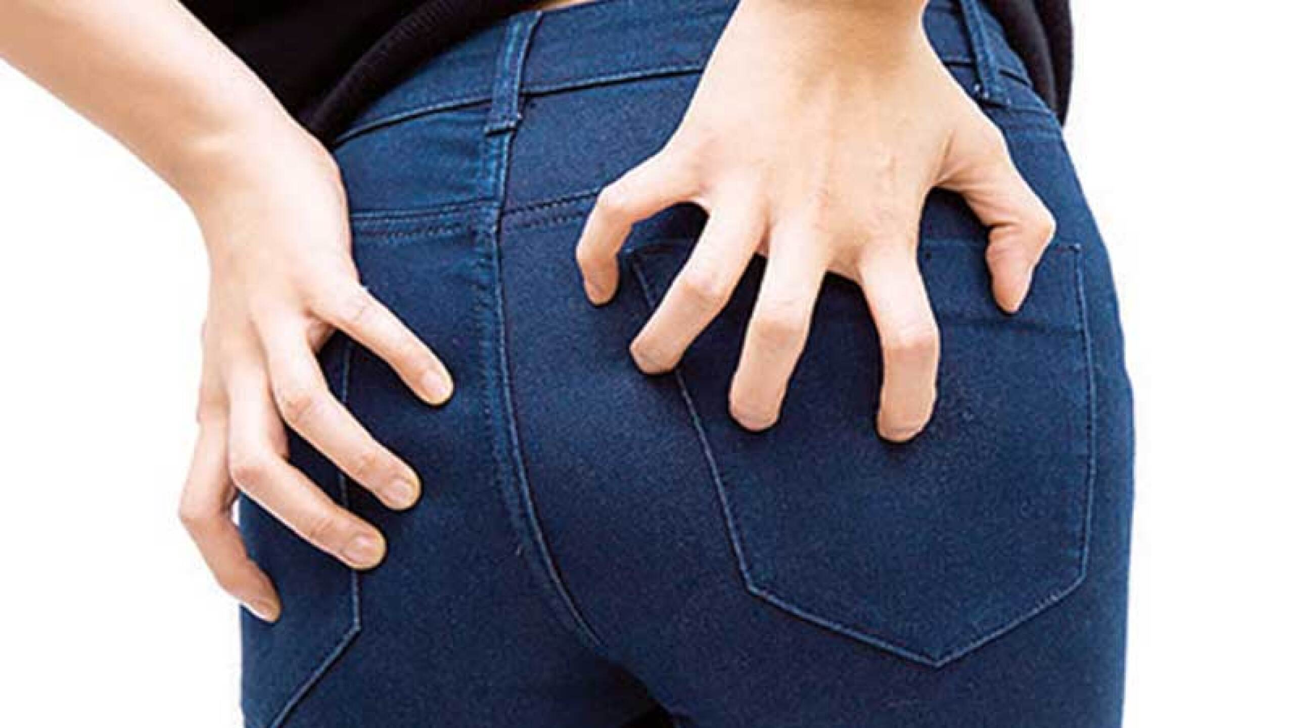 Las hemorroides son muy complicadas