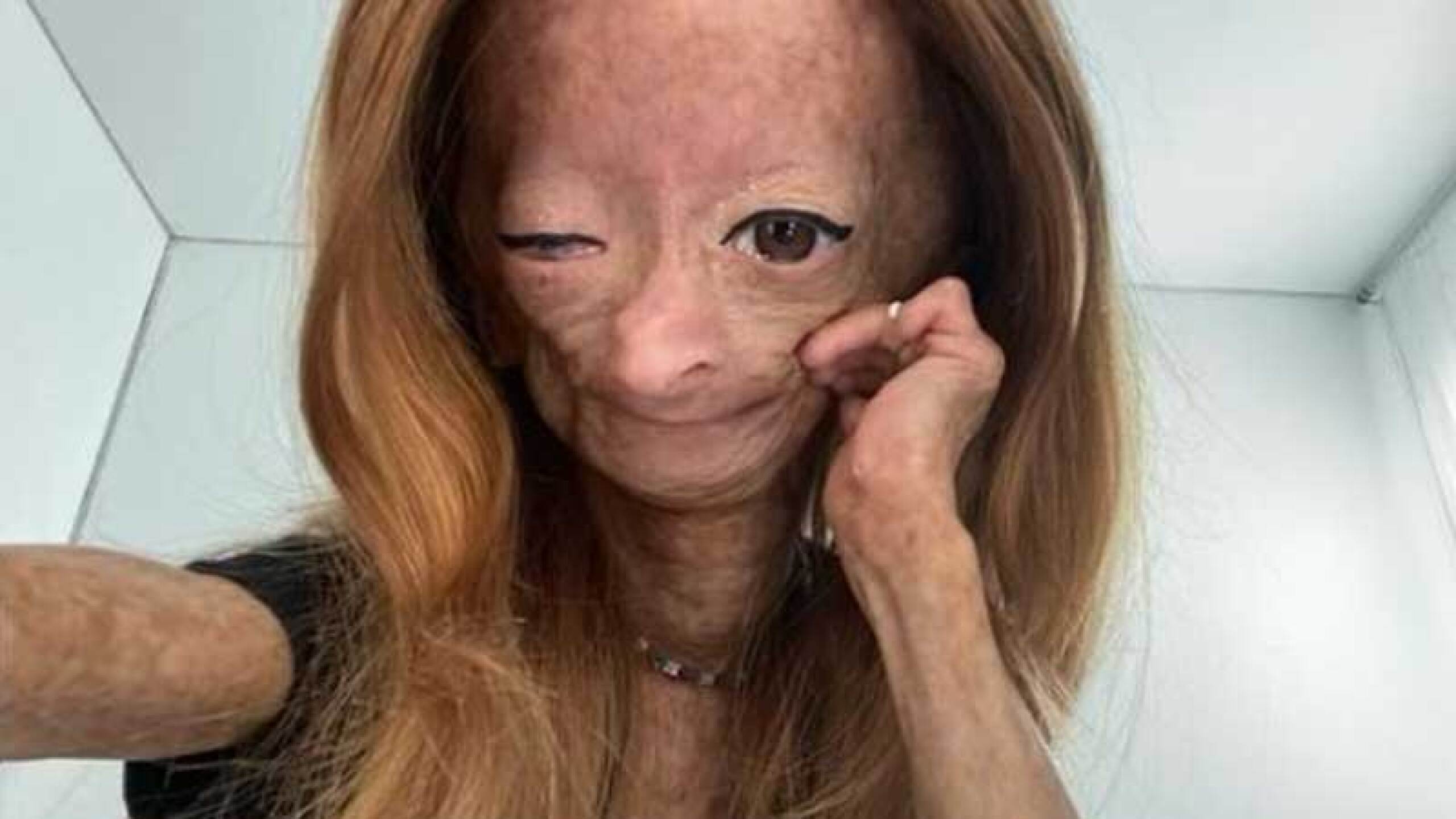 Muere Adalia Rose Williams, la youtuber que inspiró la película de Benjamin Button