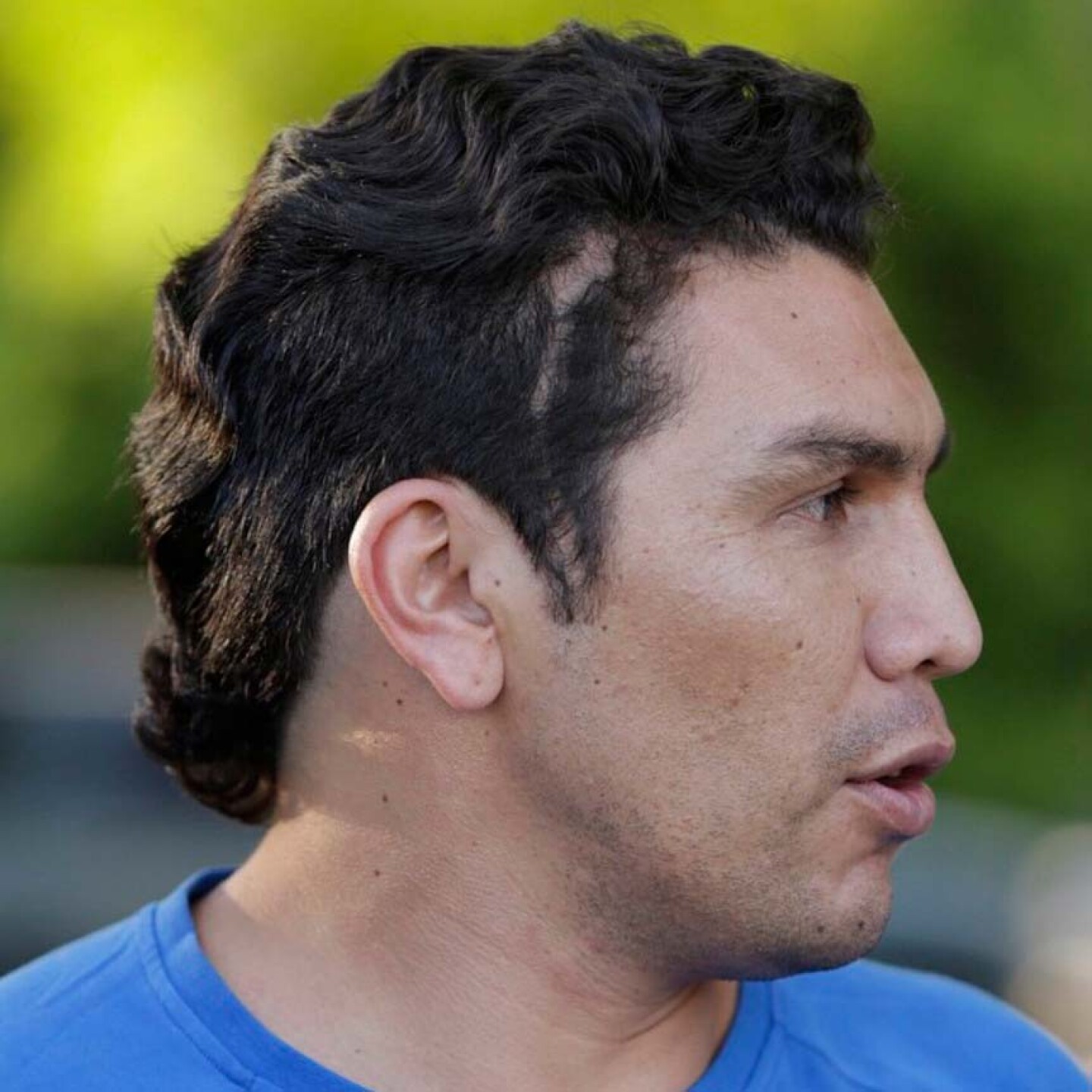 Salvador Cabañas muestra una cicatriz, tras la agresión que sufrió