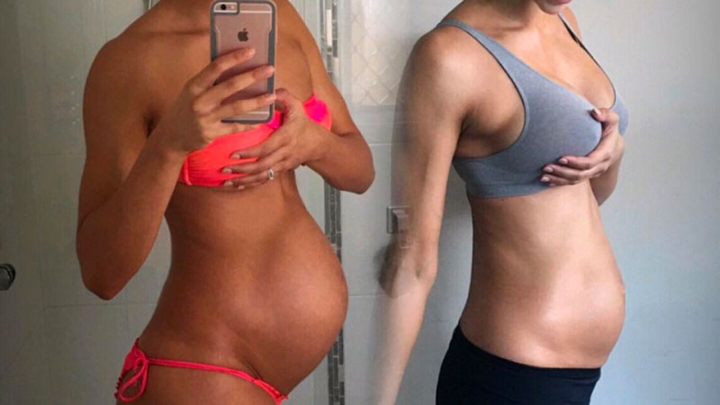 Mamá fitness puso en peligro la vida de su bebé por ejercitarse durante casi todo su embarazo.