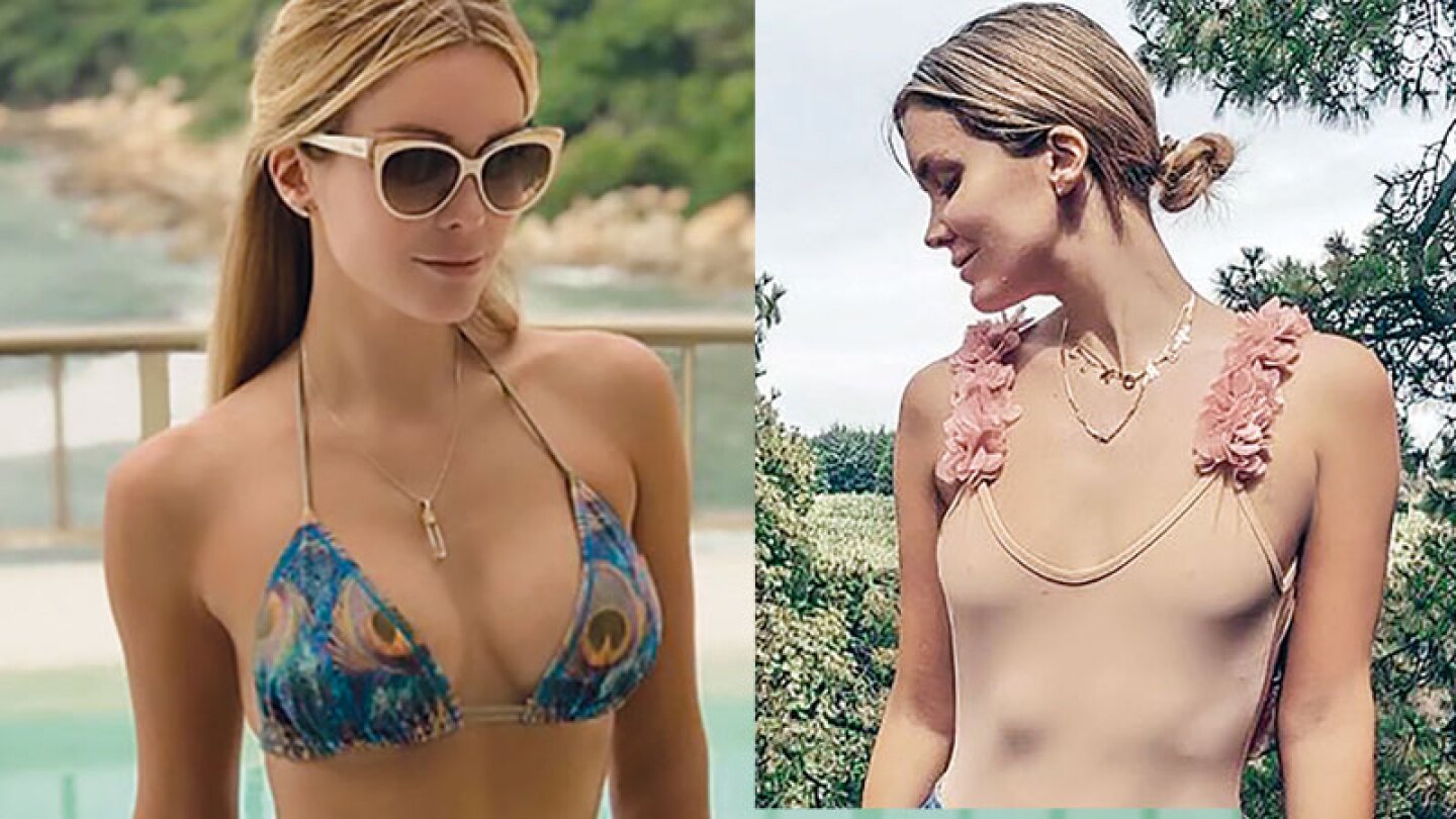 Verónica Montes pasó de 34C a 32A, ¡se quitó los implantes por salud!