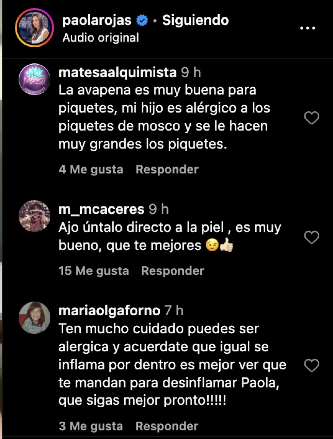 Paola Rojas se accidenta haciendo ejercicio; este es su estado de salud