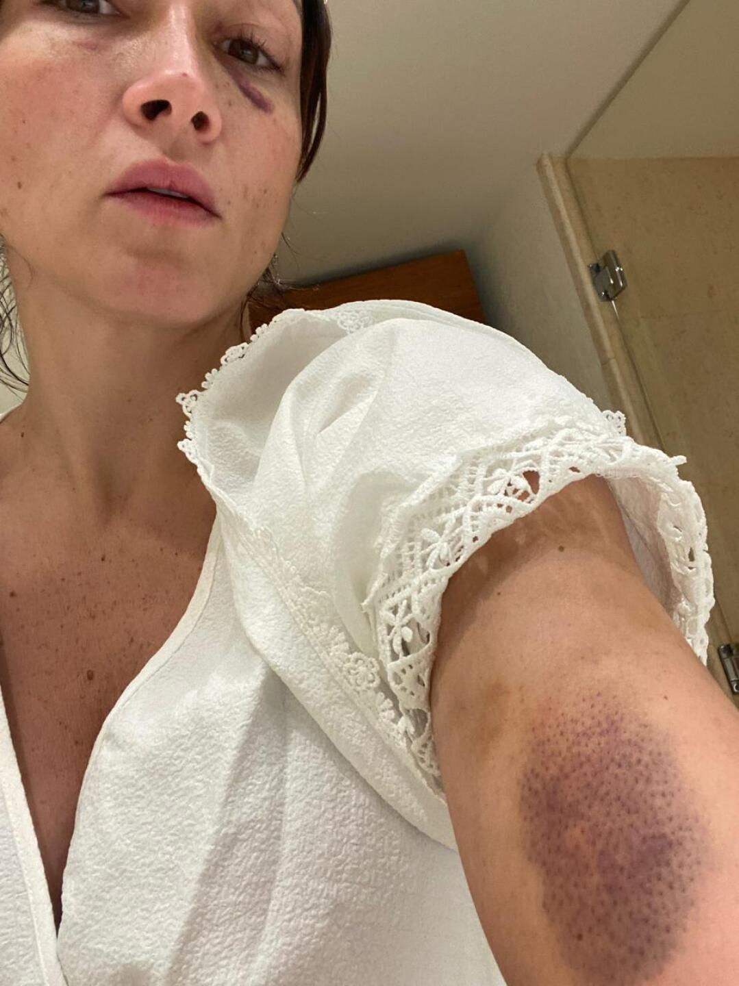 Laura Vignatti muestra las señales de violencia