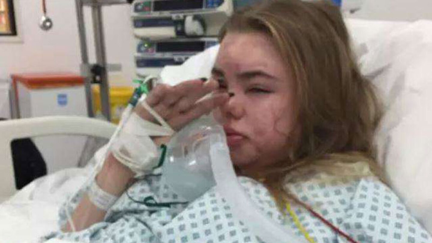 Difunde impactantes fotos de su hija en coma para advertir sobre los peligros de una droga