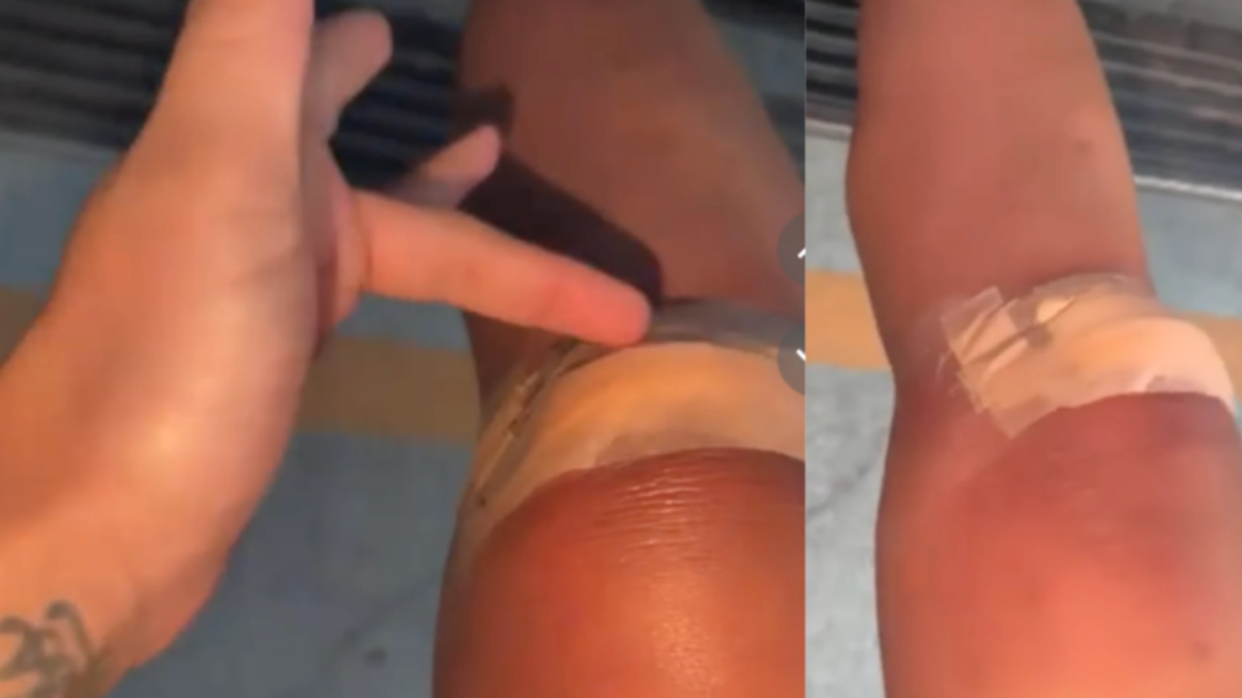 Paola Suárez herida en la rodilla en 2023