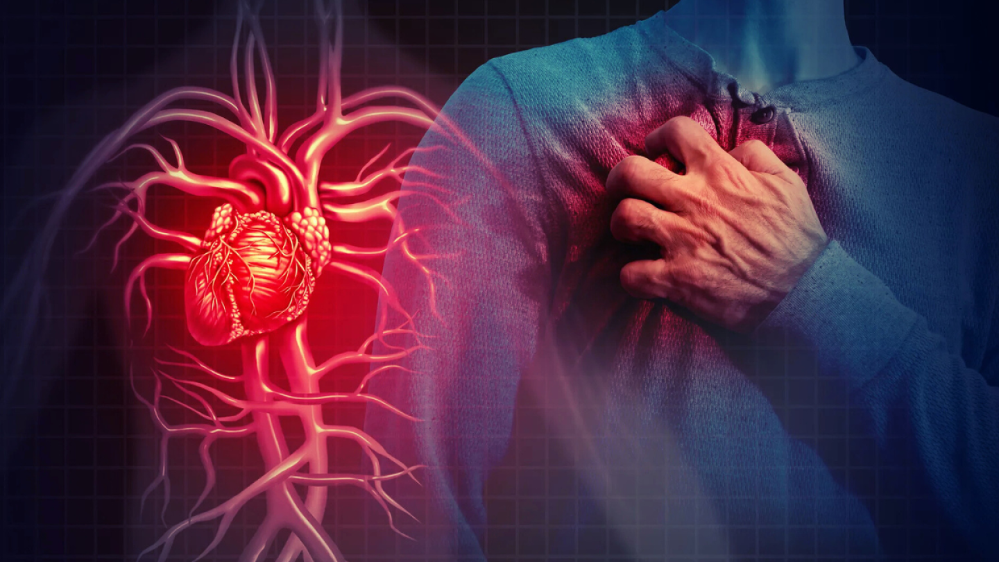 Infarto