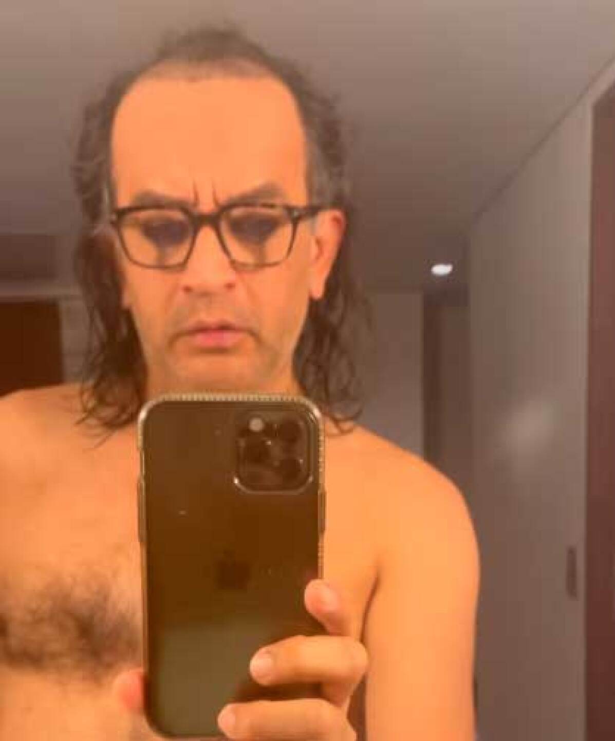 Germán Ortega confiesa que no puede tener intimidad tras el injerto de cabello